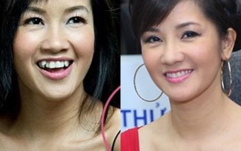Chuyện cái Hàm Răng.Phiếm của Ký Dỏm