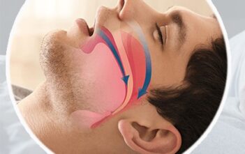 Ngủ ngáy không phải cho ‘vui nhà’ mà có nguy cơ đột tử, ngừng thở