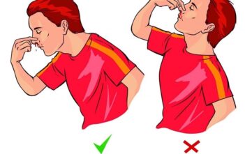 Chảy máu cam mà ngửa đầu ra sẽ viêm phổi?